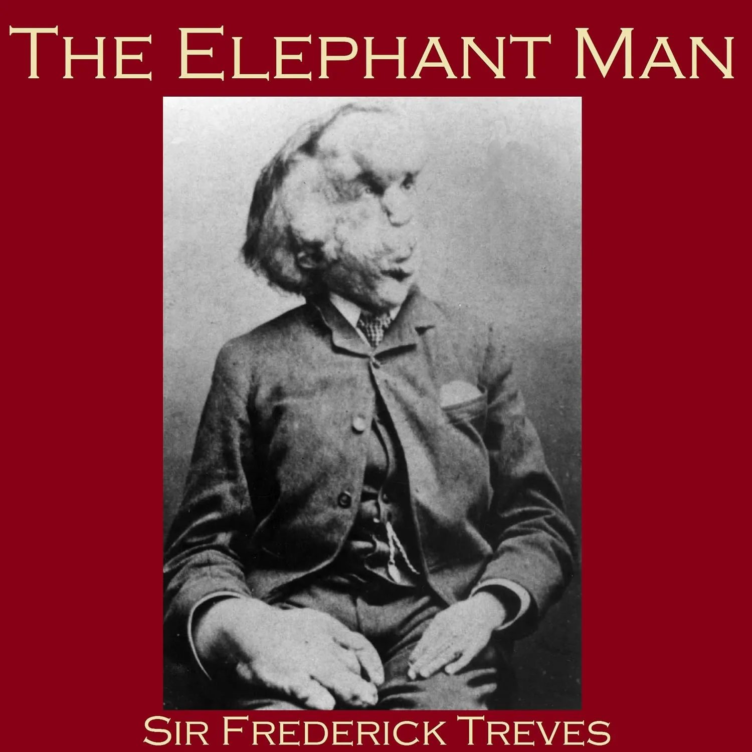 Portada de The Elephant Man
